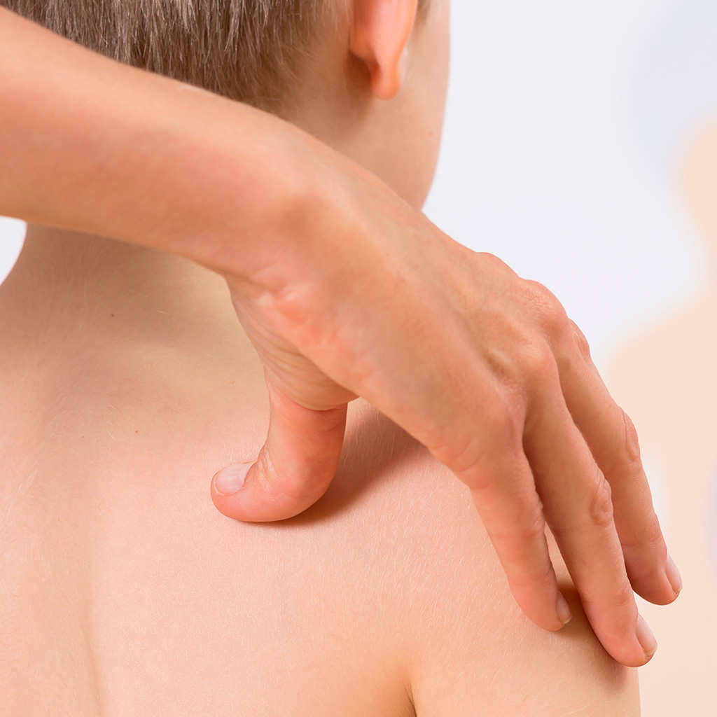 Intervencao_Fisioterapia_Escoliose_SMALL